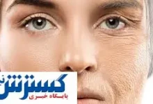خوراکی ارزان قیمتِ ضد پیری کشف شد