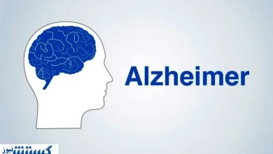 با آزمایش ۳ دقیقه ای آلزایمر را در نطفه خفه کنید !
