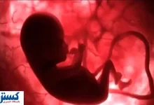 دولت شرایط سقط جنین قانونی را اعلام کرد | کدام روش بهتر است د؟