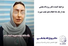 جوانی ماندگار با لیفت صورت: راهنمای انتخاب جراح و بررسی هزینه‌ها در سال ۱۴۰۴