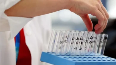 پرسپولیس و چادرملو زیر تیغ دوپینگ