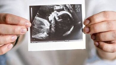 ویزیت رایگان مادران باردار ادامه دارد