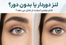 تفاوت لنز دوردار و بدون دور روی چشم